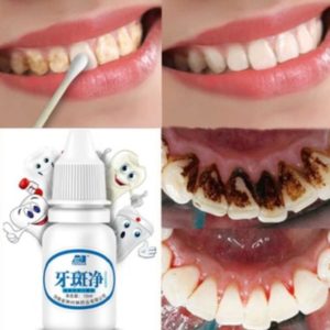 Teeth Whitening Solution. Teeth Cleaning & Whitening Liquid